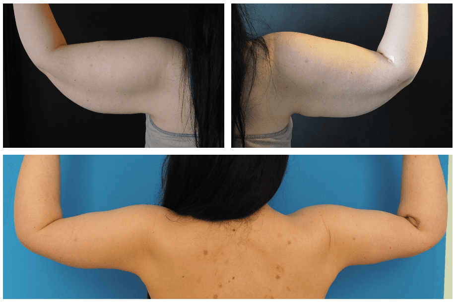 Kazanavičius-žastai