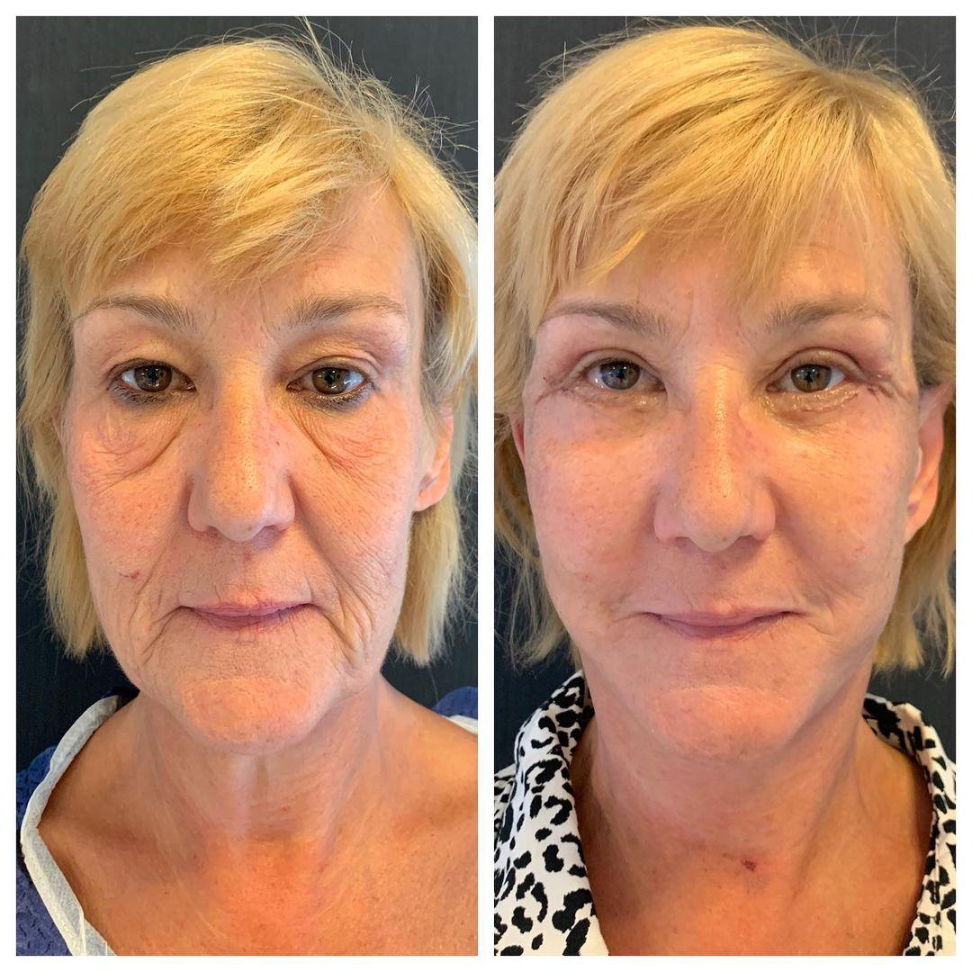 295527473_1095806331317781_5725121580237165428_n