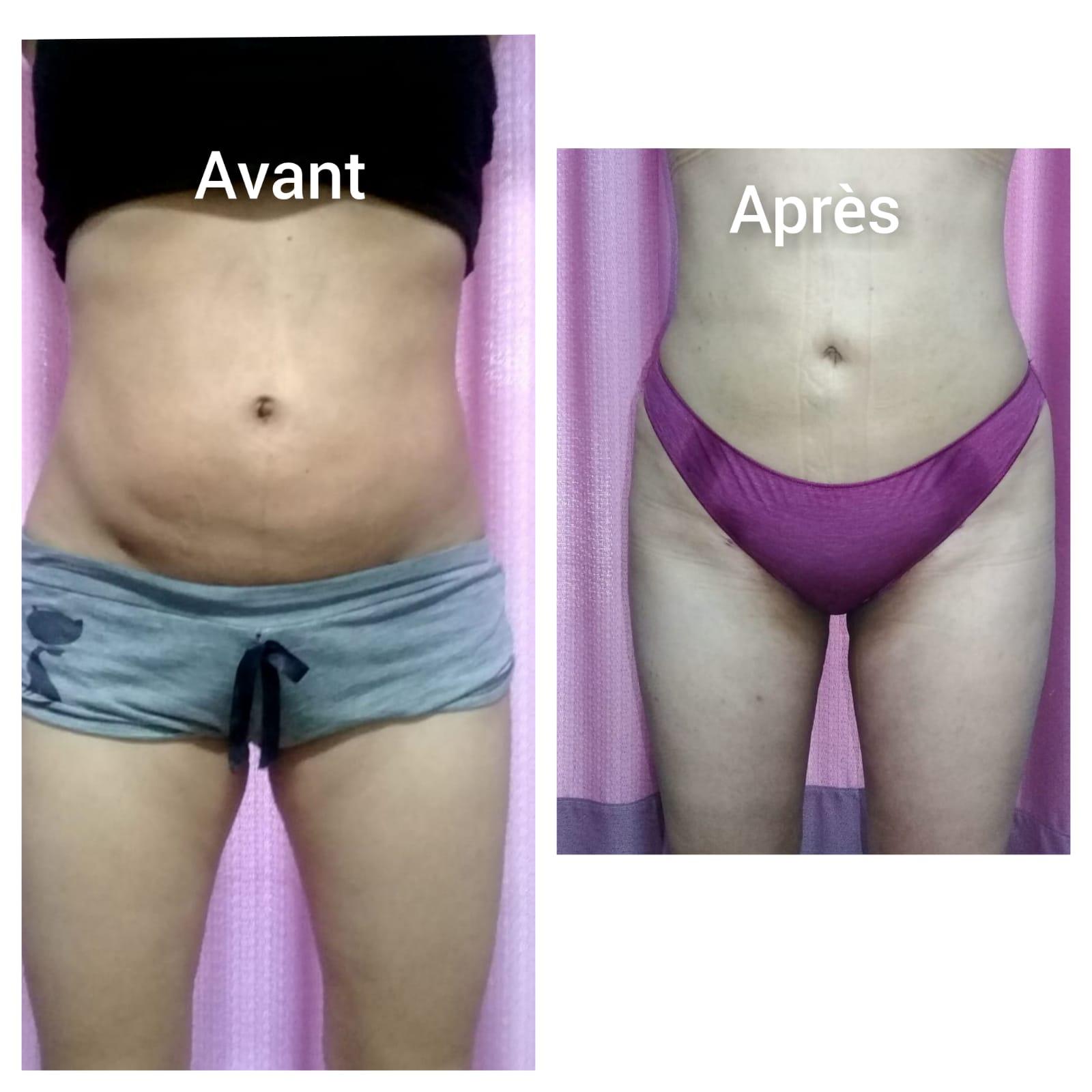 Zaghouan surgery results3