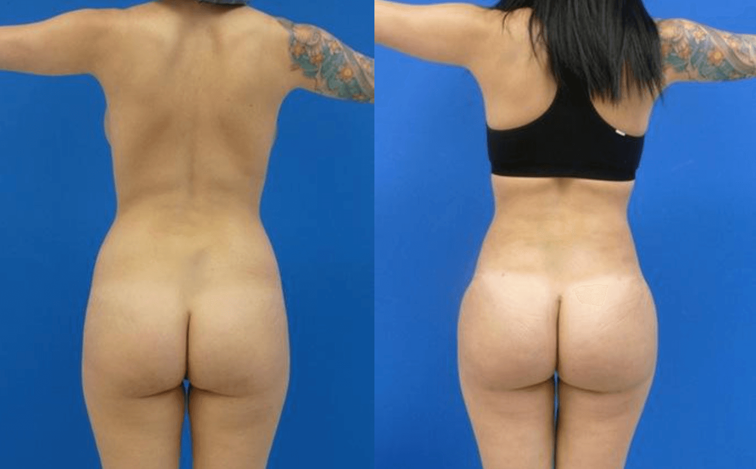 Results BBL by Dr Miklos Molnar