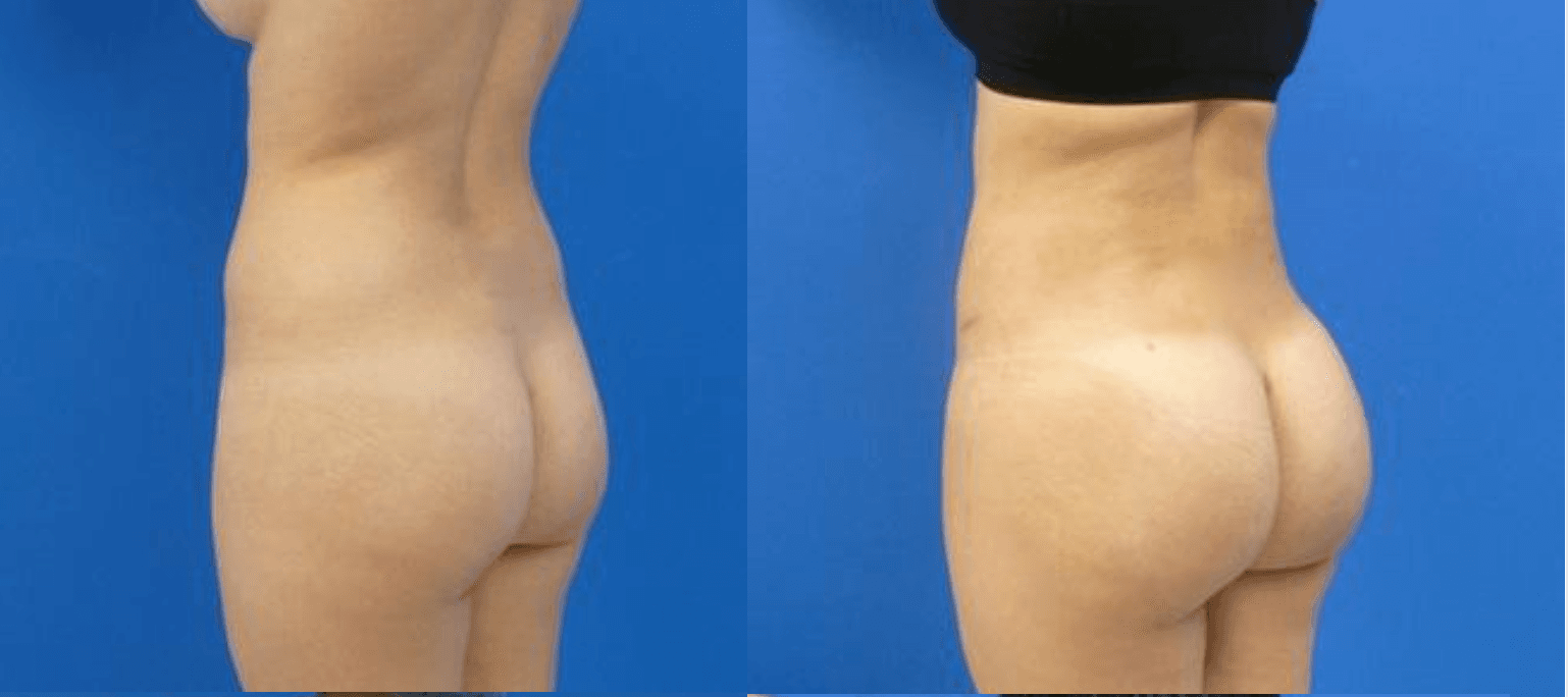 Results BBL by Dr Miklos MolnarCapture d’écran 2023-02-16 à 10.53.05