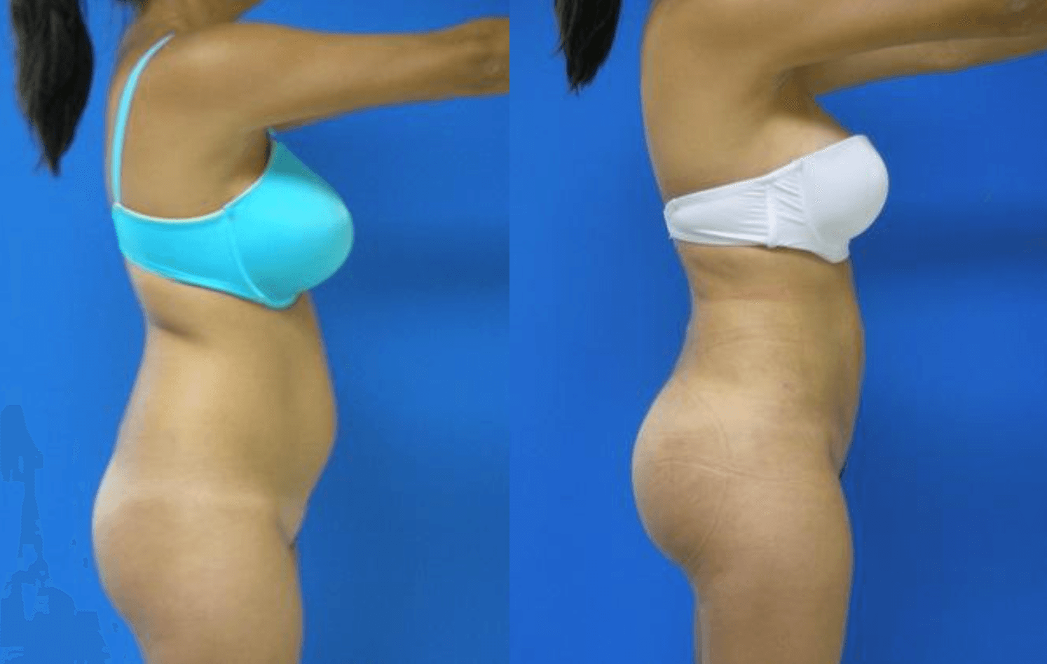 Results BBL by Dr Miklos Molnar