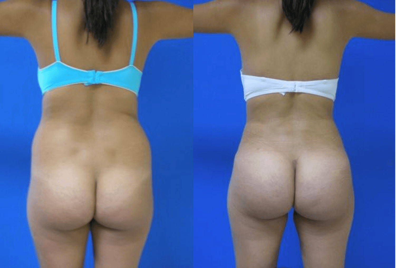 Results BBL by Dr Miklos Molnar