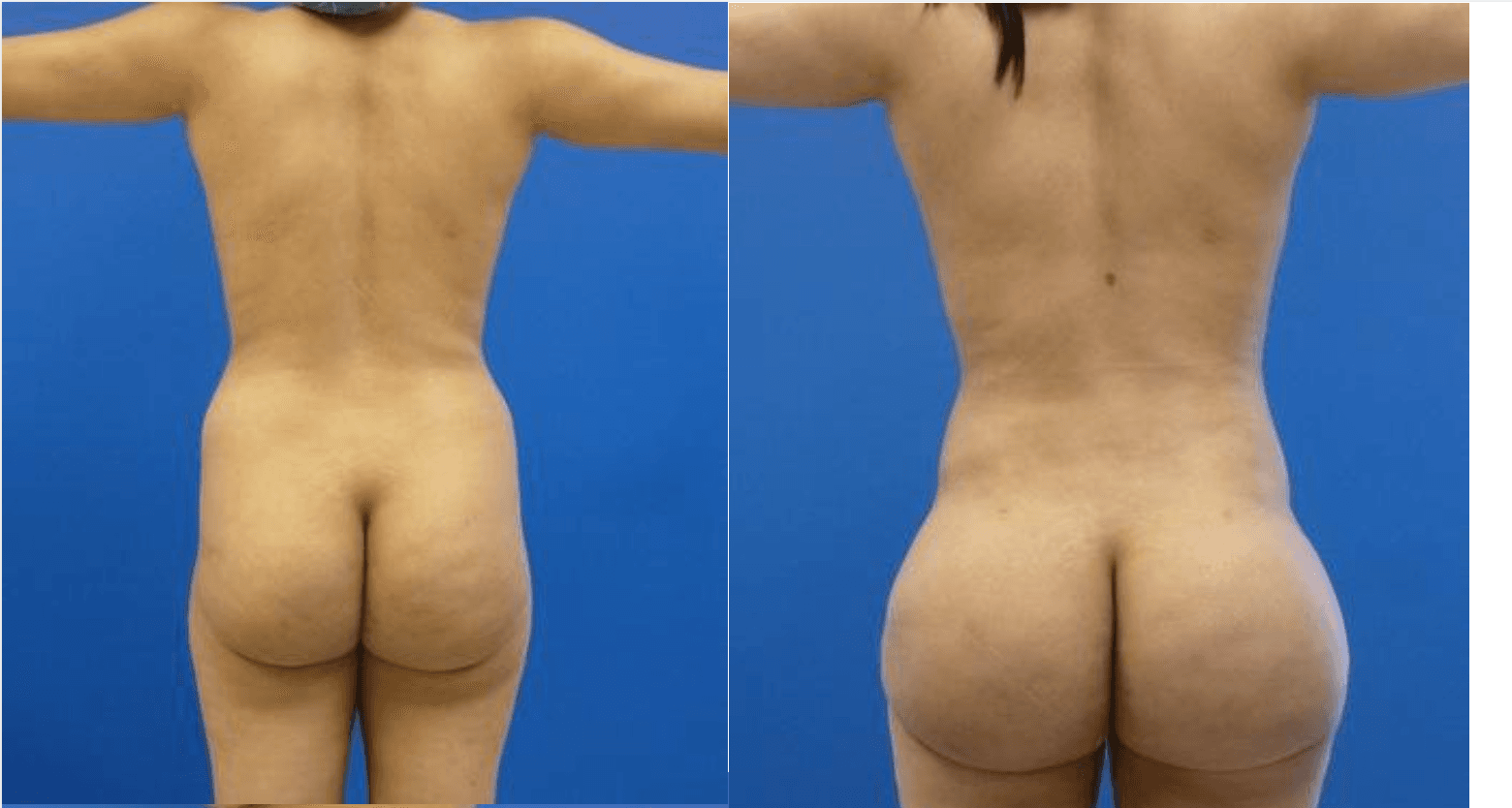 Results BBL by Dr Miklos Molnar