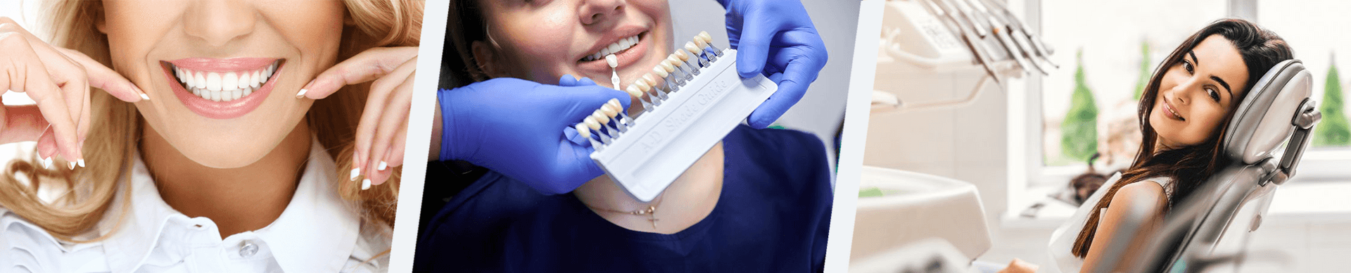 Hollywood Smile: How to Get the Perfect Smile with or Without Filing banner