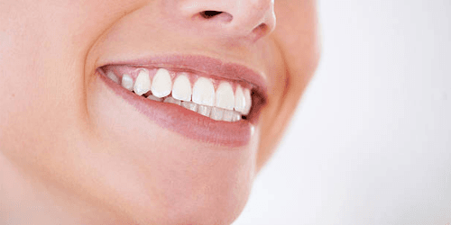 Guide du relooking du sourire 2026 : facettes, tarifs et meilleures cliniques
