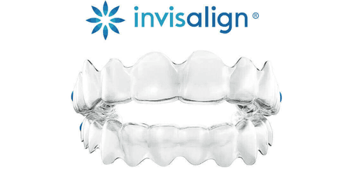 Invisalign