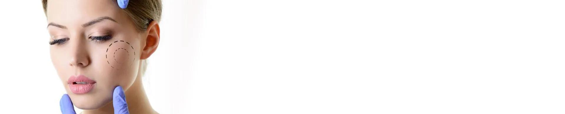 Lipofilling facciale — Esthetic Planet