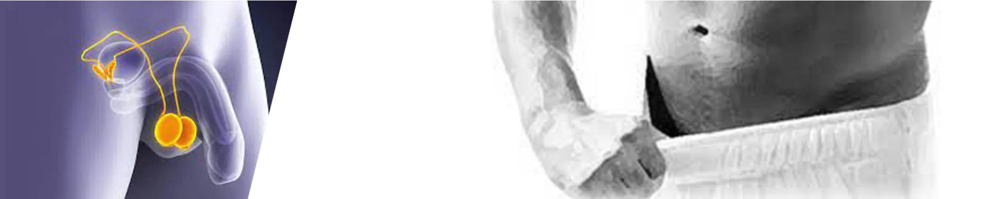 Rejuvenecimiento testicular — Esthetic Planet