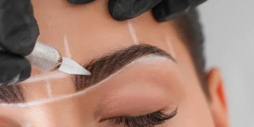 Greffe de Sourcils