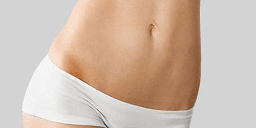 Abdominoplastie