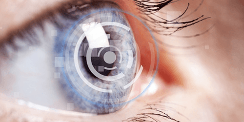 Implants multifocaux