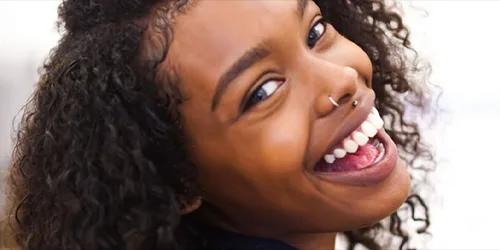 Sonrisa de Hollywood