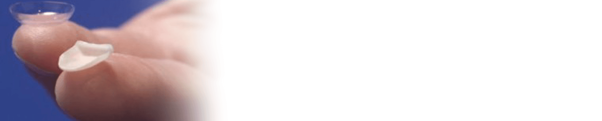 Facettes Pelliculaires banner