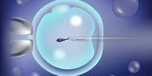 IVF - ICSI