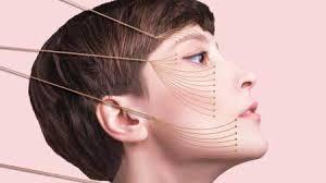 Fili di tensionamento