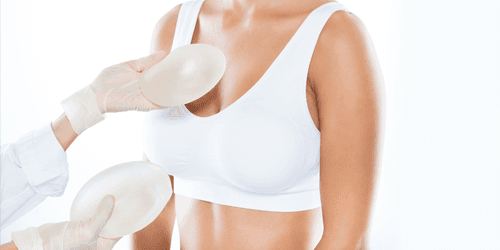 Implants Ronds