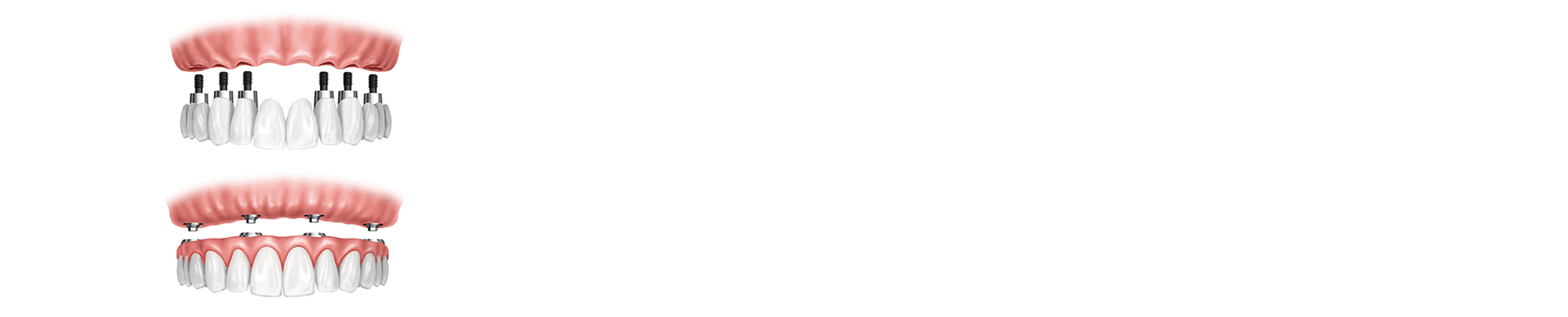Soins Dentaires banner