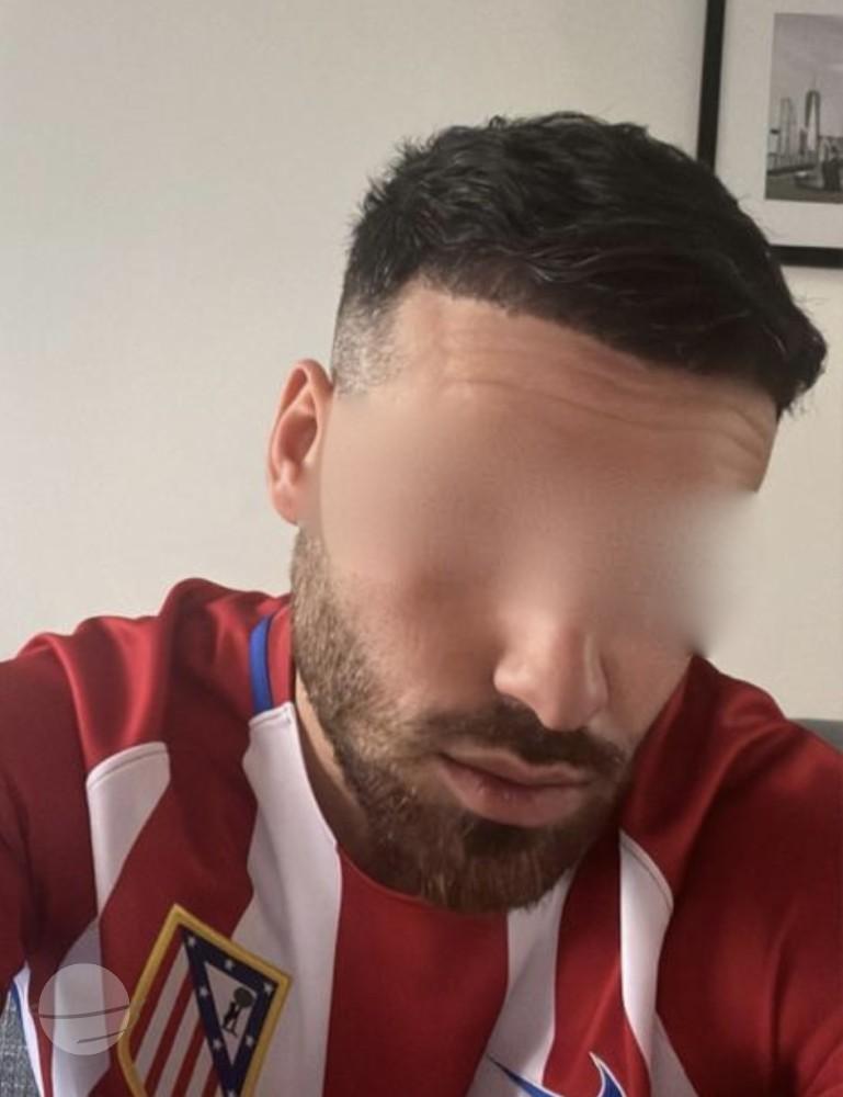 Dr Sofiene Ouerghi before : after9