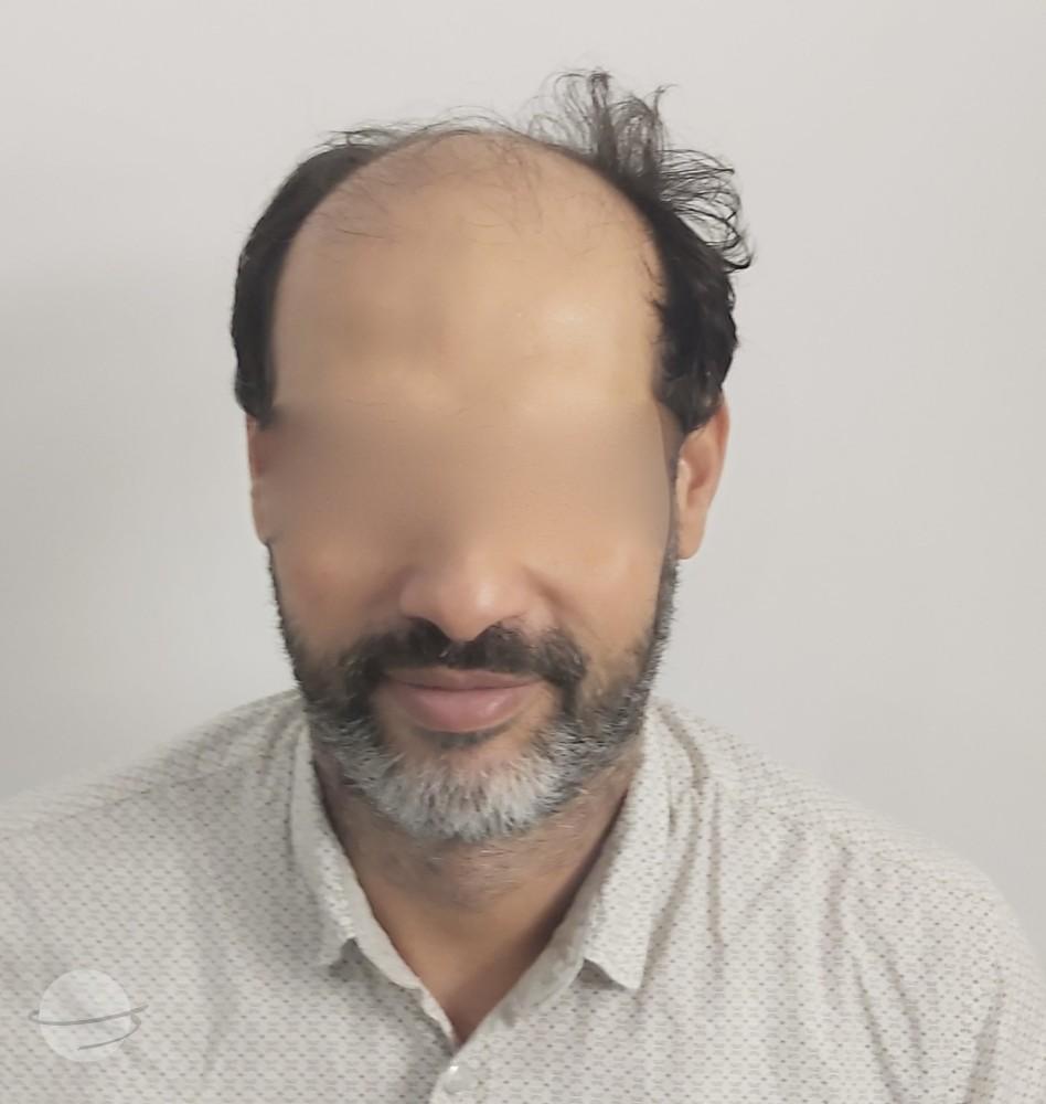 Dr Sofiene Ouerghi before : after6