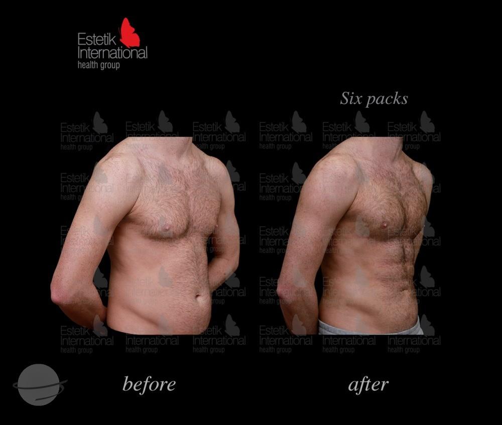 Estetik international results61