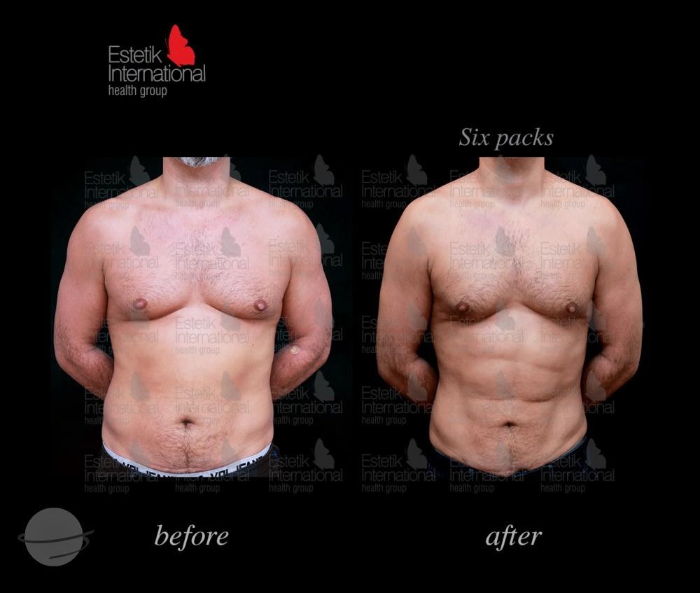 Estetik international results63