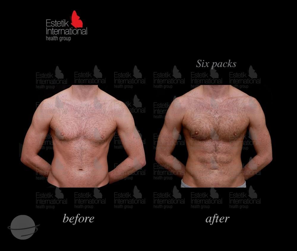 Estetik international results62