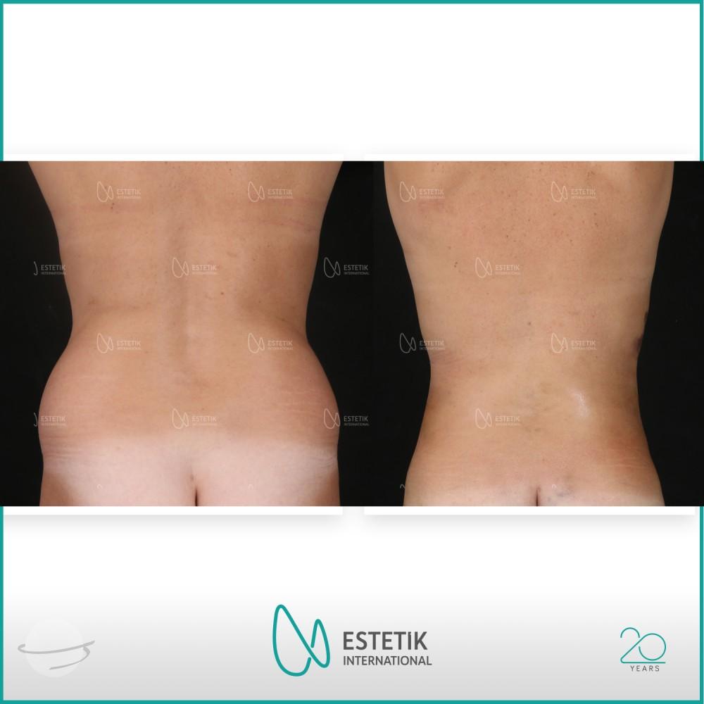 Estetik international results9