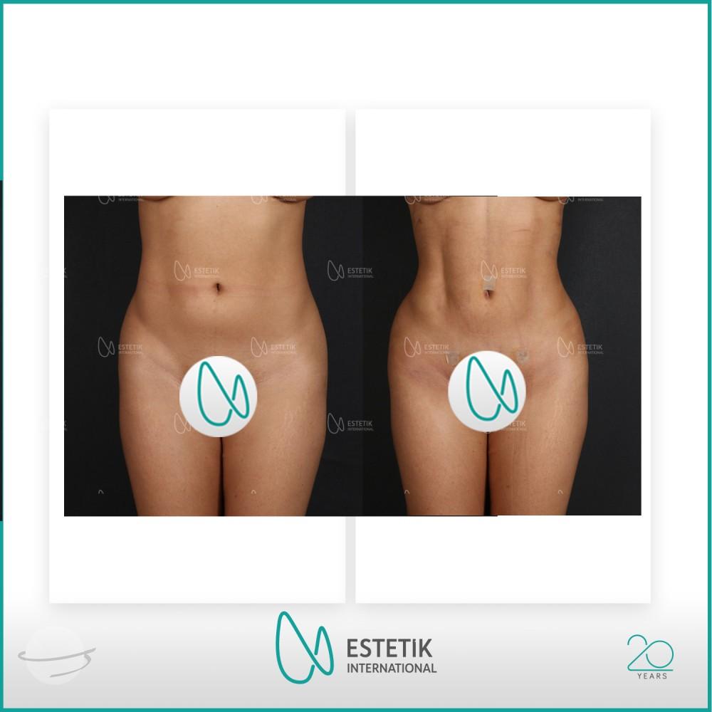 Estetik international results14