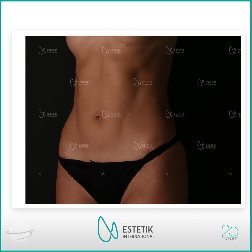 Estetik international results15