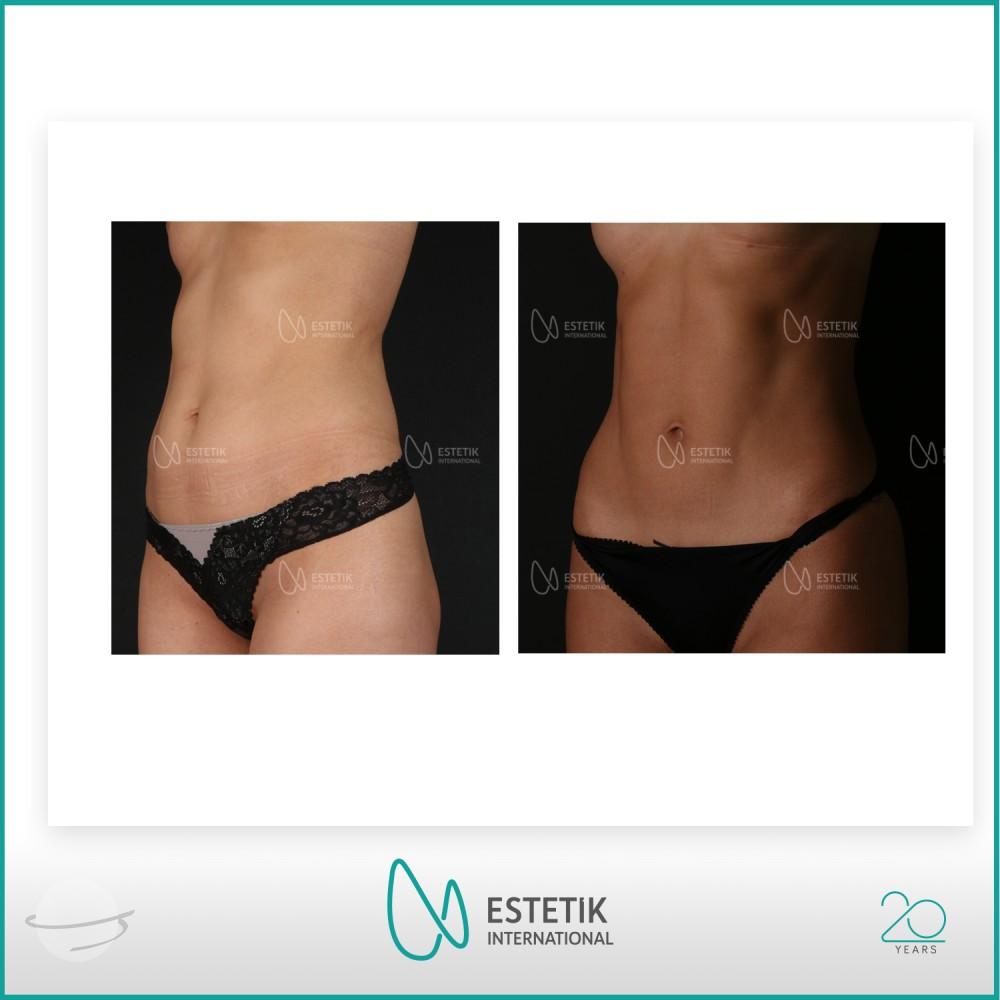 Estetik international results17