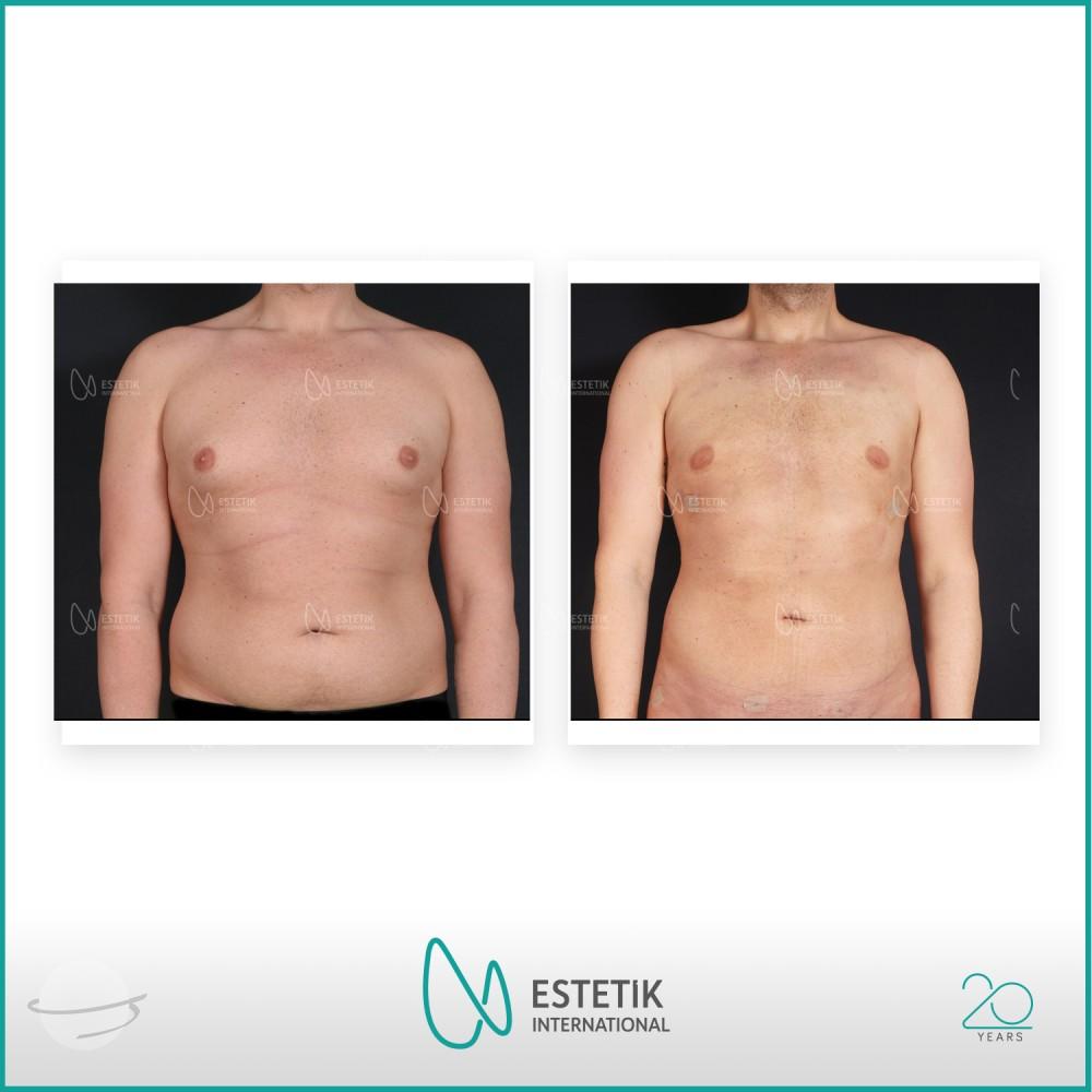 Estetik international results22