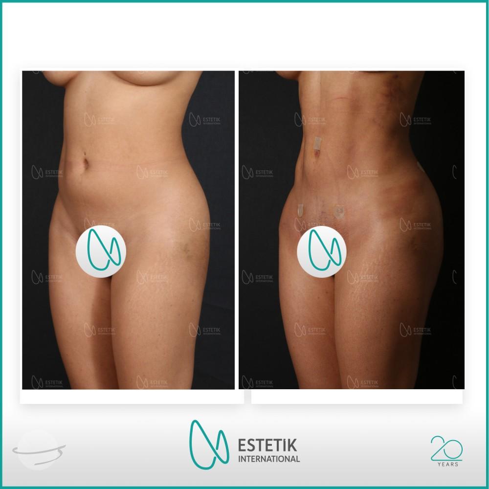 Estetik international results25