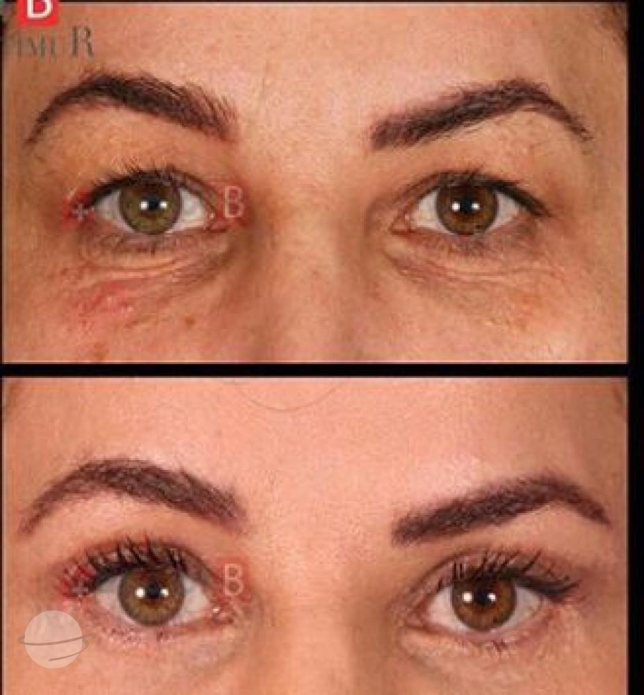 Estetik international results71