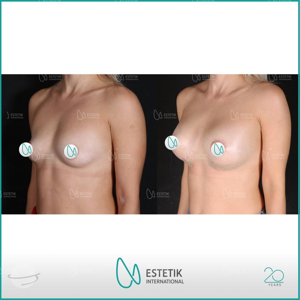 Estetik international results34