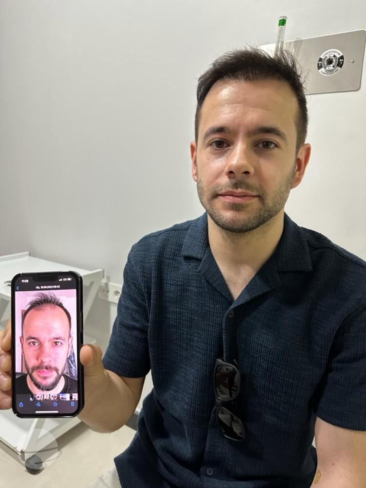 Hope Hair Health Resultats