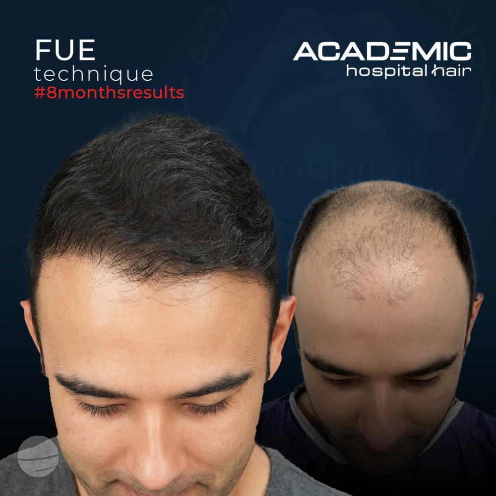 Mustafa Ugur-2_B-A_KOYU