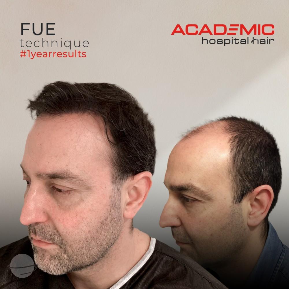 MİGUEL ANGEL SANZ HERNANDEZ_ACIK-2