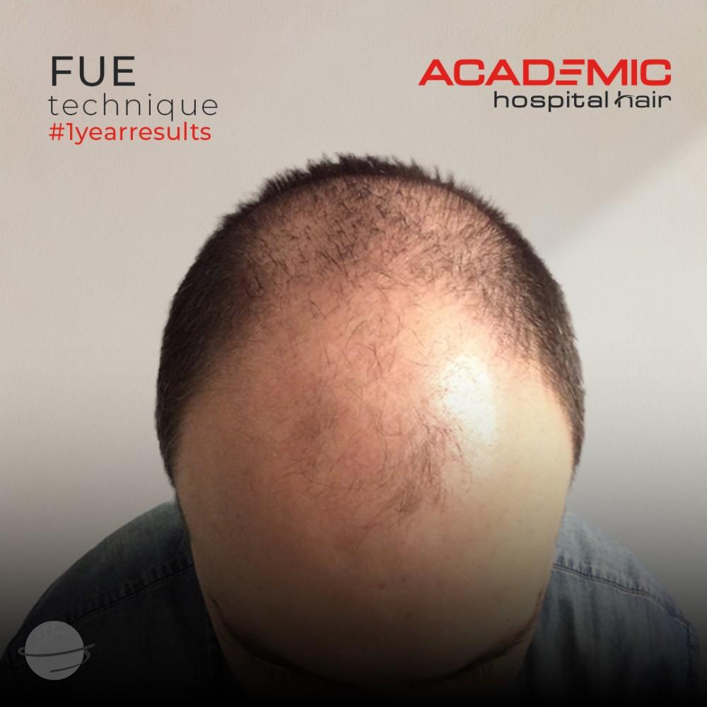 MİGUEL ANGEL SANZ HERNANDEZ_ACIK-3