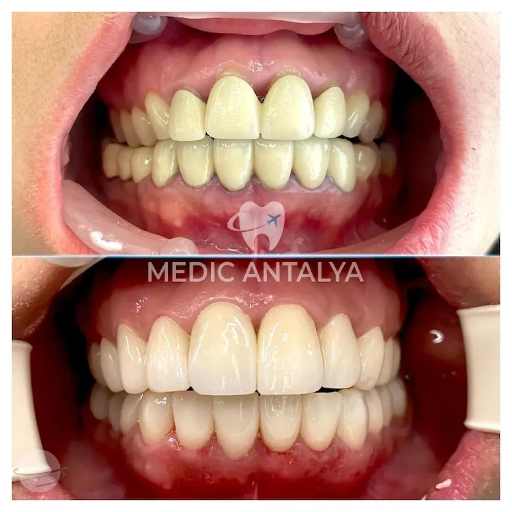 Medic antalya - Dental results24