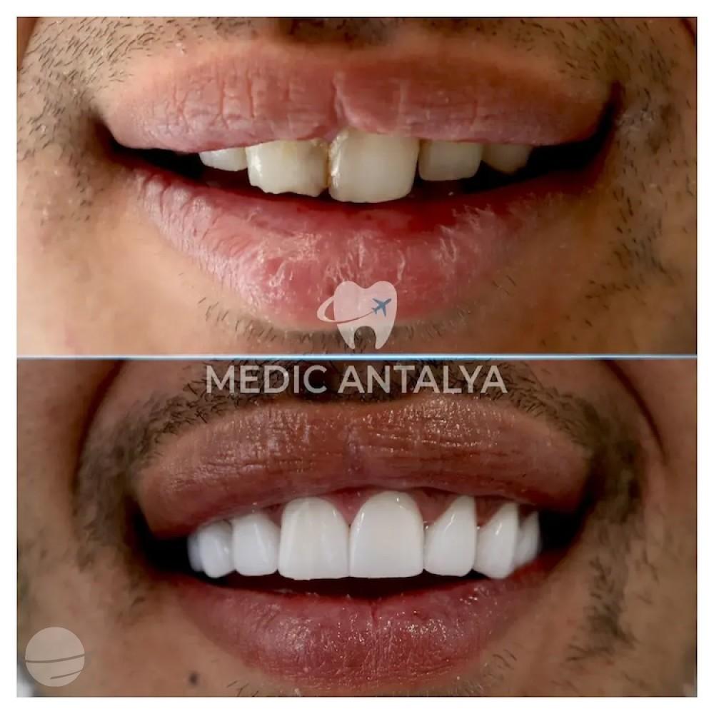 Medic antalya - Dental results20