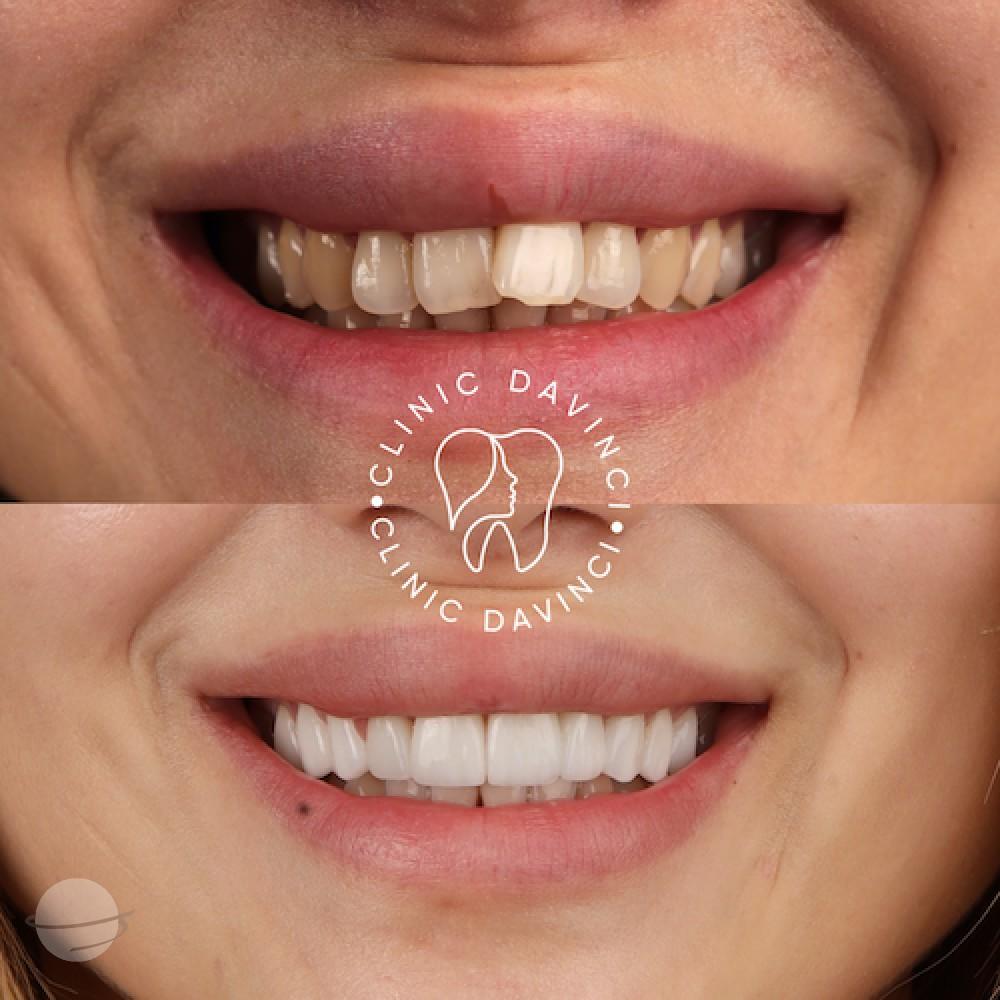 DA VINCI DENTAL RESULTS2