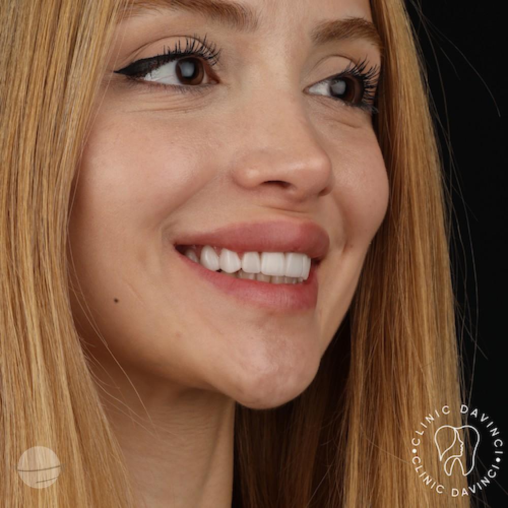 DA VINCI DENTAL RESULTS3