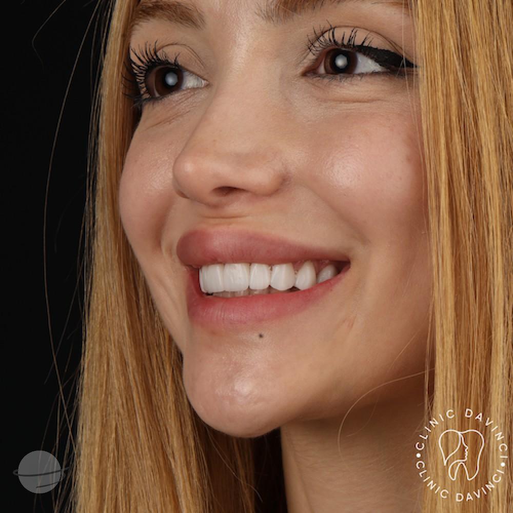 DA VINCI DENTAL RESULTS4
