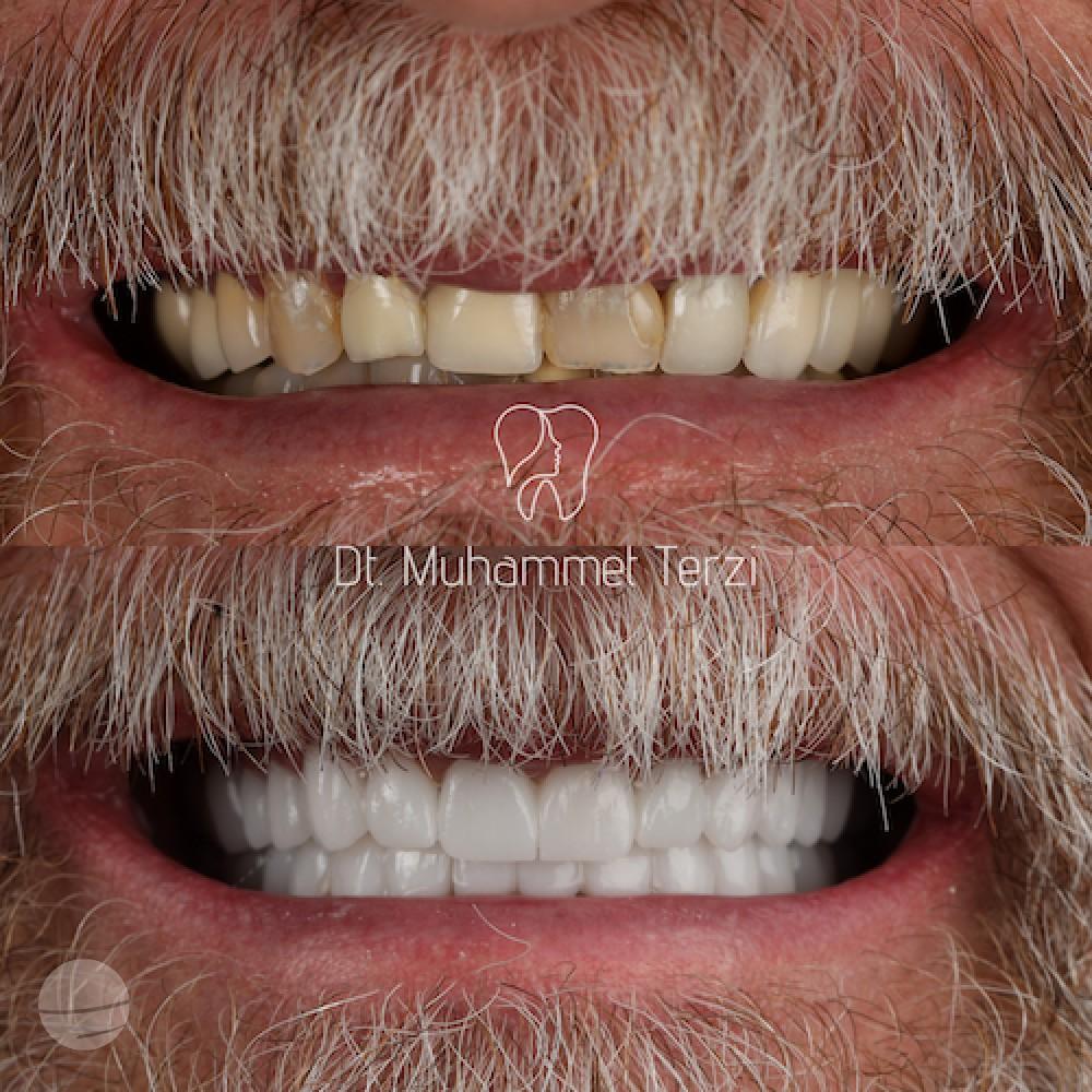 DA VINCI DENTAL RESULTS8