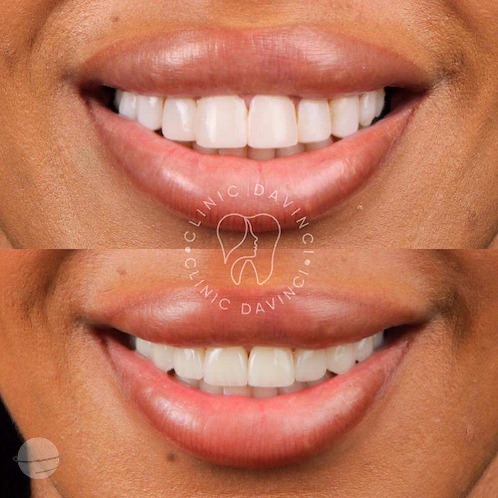 DA VINCI DENTAL RESULTS9