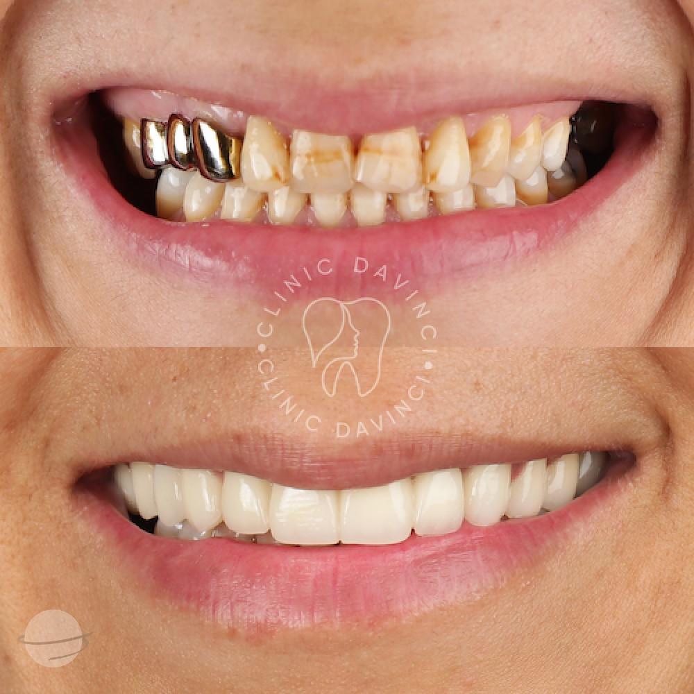 DA VINCI DENTAL RESULTS10
