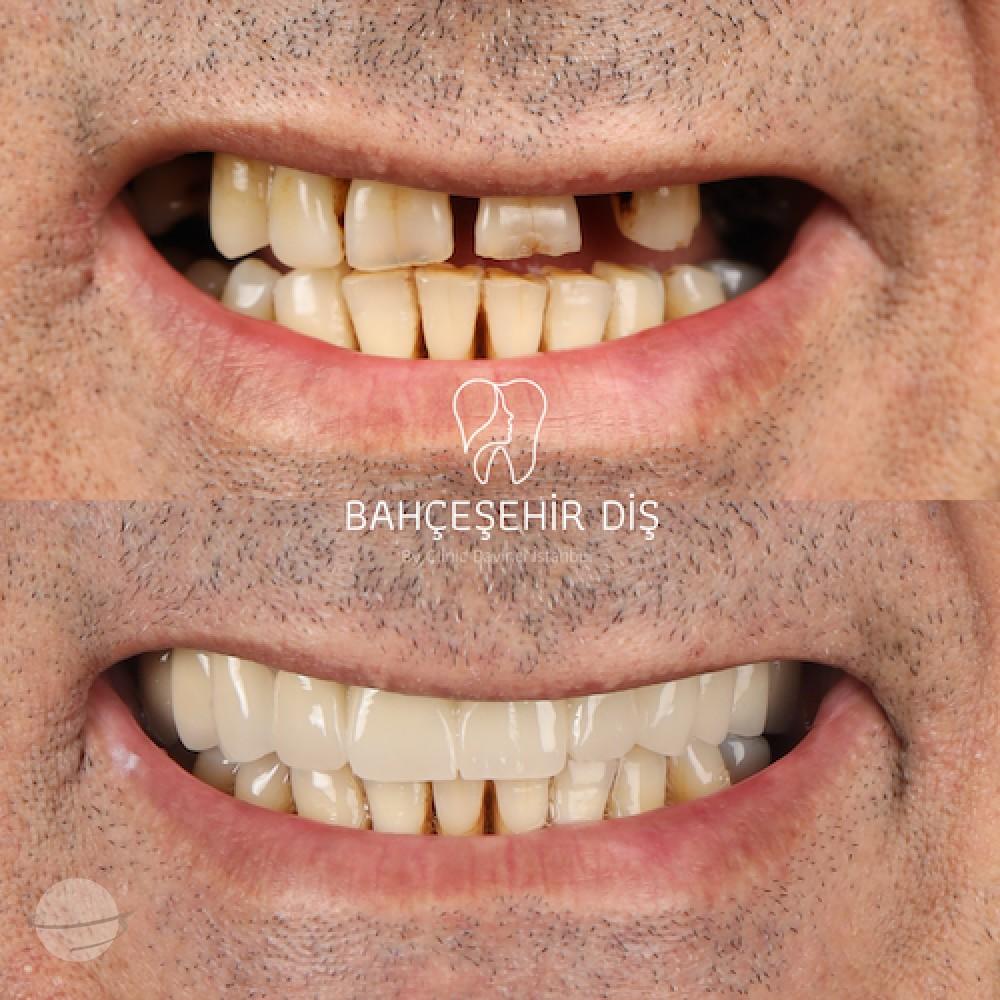 DA VINCI DENTAL RESULTS12