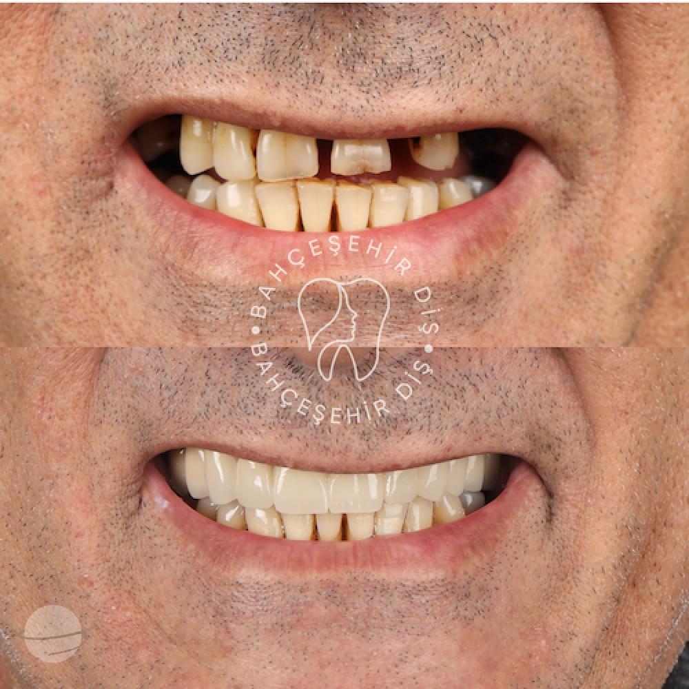 DA VINCI DENTAL RESULTS15