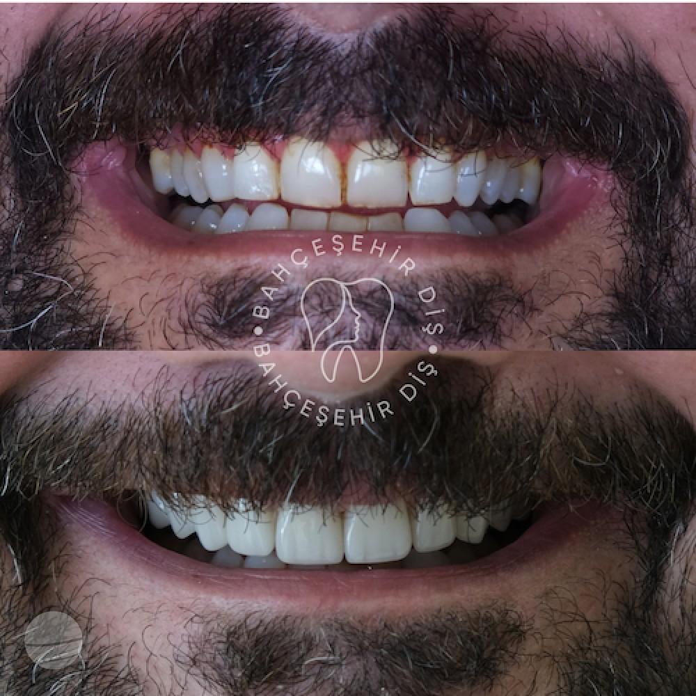 DA VINCI DENTAL RESULTS16